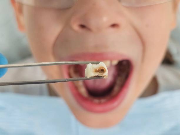 Best Pediatric Emergency Dentist in Silver Hill, MD